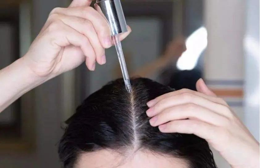 how to solve and prevent the problem of widening hair seams in daily life