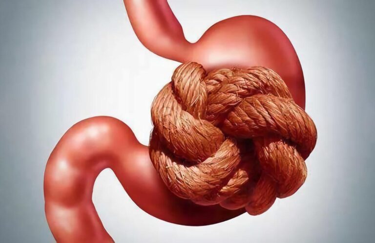 7 kinds of vegetables and fruits that help repair the gastric mucosa and protect the stomach