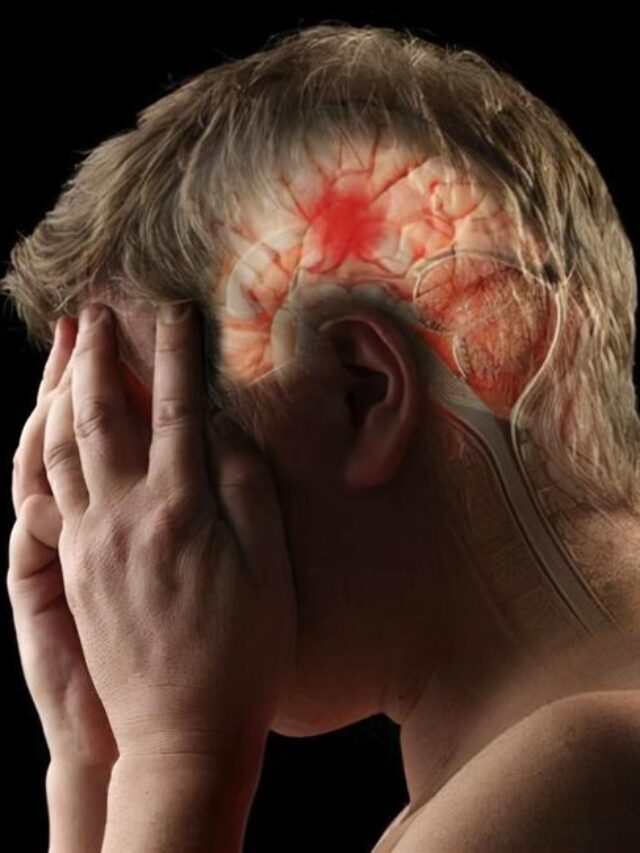 Do these 5 things to prevent strokes