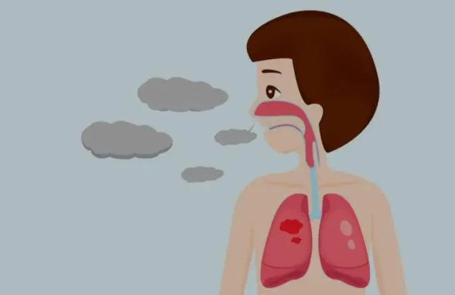 how to  pretend our lungs from tuberculosis