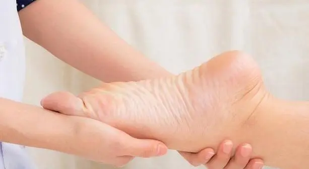 Long-lived women have very broad big toes