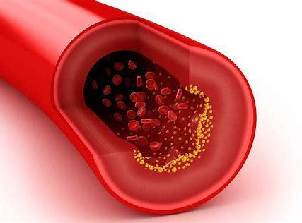 how to improve cholesterol level 