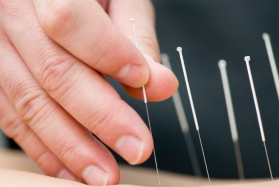 Will regular acupuncture damage nerves?