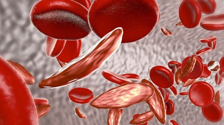 What happens to the body when there is moderate anemia