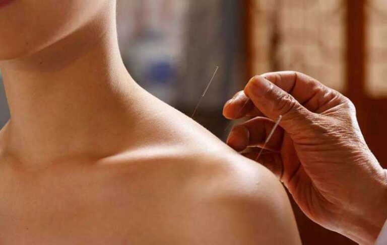 Will regular acupuncture damage nerves