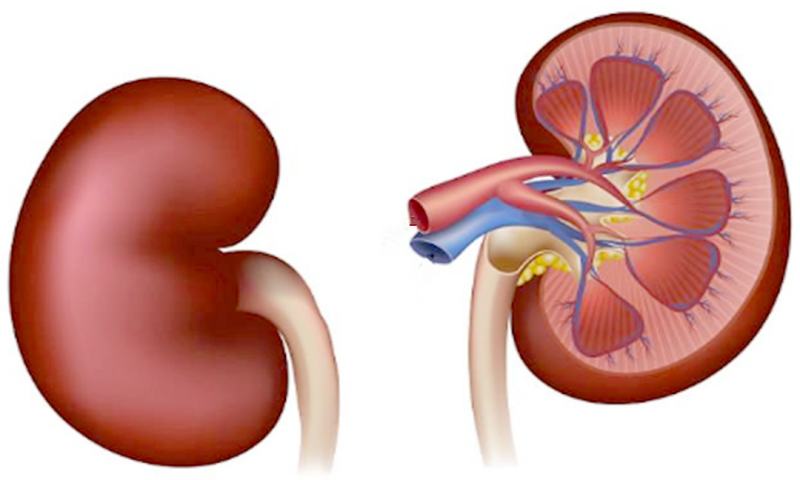How to Avoid Chronic Kidney Disease Development, Ultimately Uremia