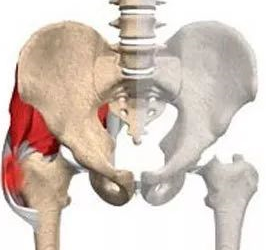 How to recover arthritis hip pain at home