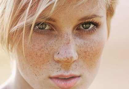 How to get rid of freckles and wrinkle 
