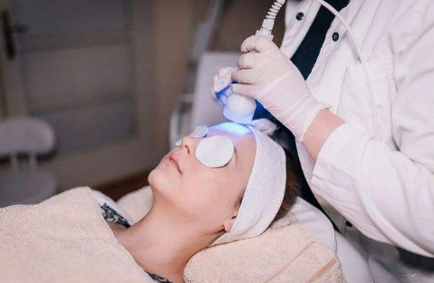 How long do the effects of a Photofacial last