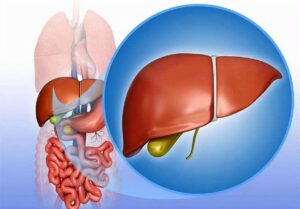Read more about the article What foods are good for liver repair sign of liver disease