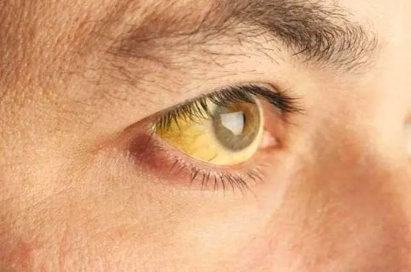 yellow eyes 