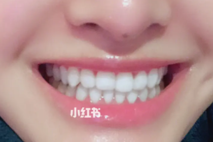 Why are the teeth that are in good shape suddenly loose