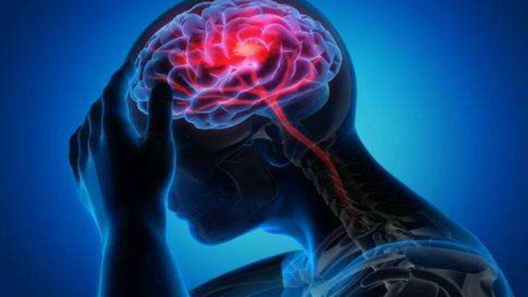 What causes neuralgia pain in the head?