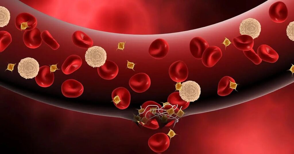 2.Coronary arteriosclerosis