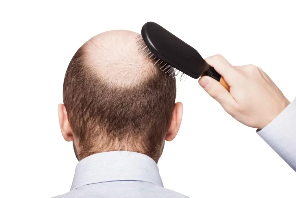 Frequent shampooing will cause hair loss? 