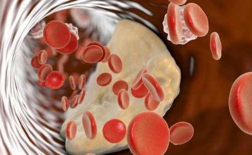 Low-density lipoprotein is high, how to adjust?