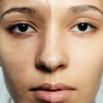 3 tricks to get rid of dull skin