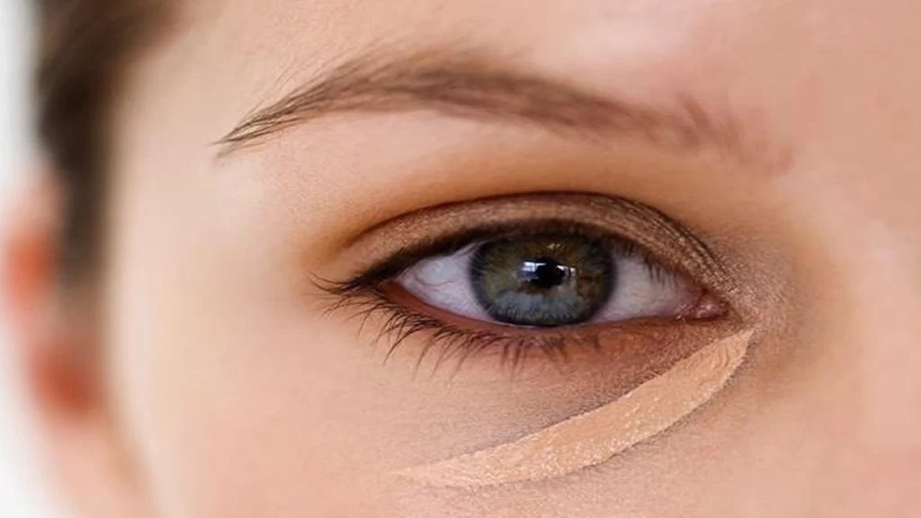 Is there a way to treat dark circles?