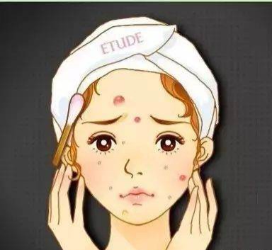 How to remove pimple and acne in short period at home
