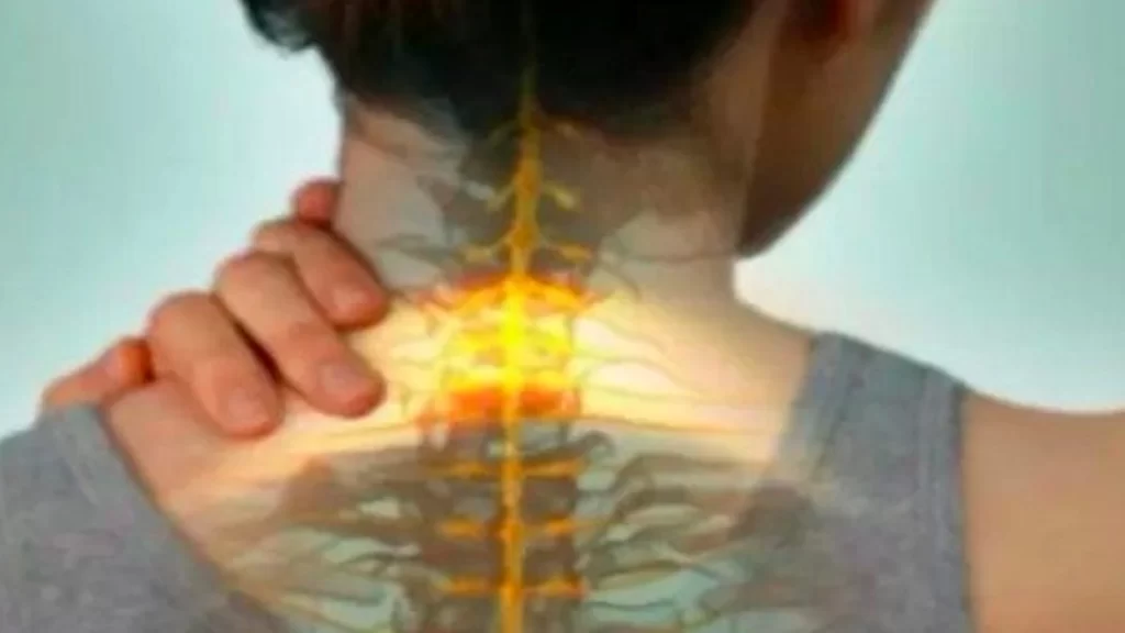 How to prevent cervical spondylosis