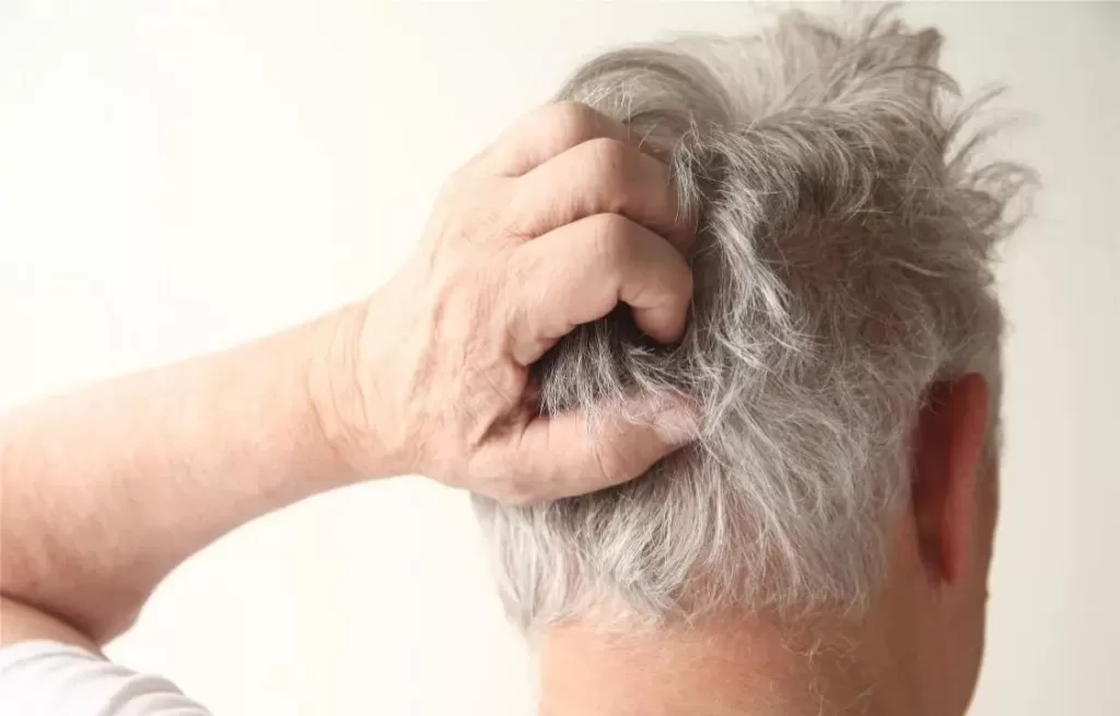 What causes pustules on the scalp?