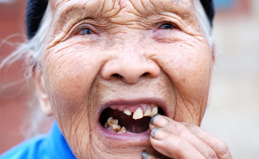3 ways to protect the teeth of the elderly