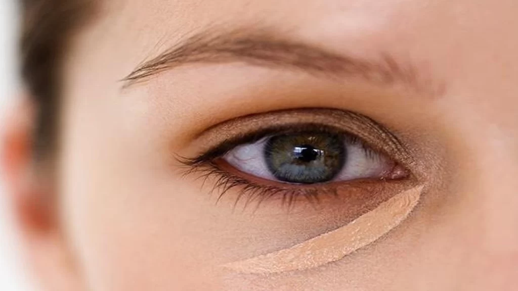    What are dark circles?