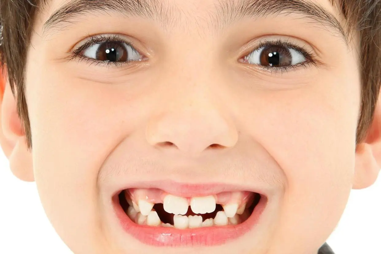 Best age for orthodontic treatment