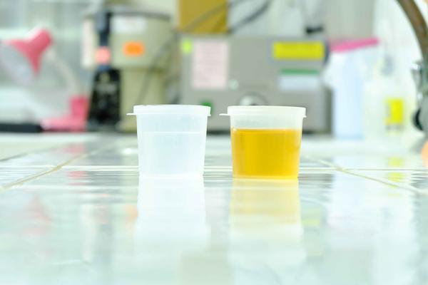 What is the reason for abnormal urine, dark yellow urine, and bad smell