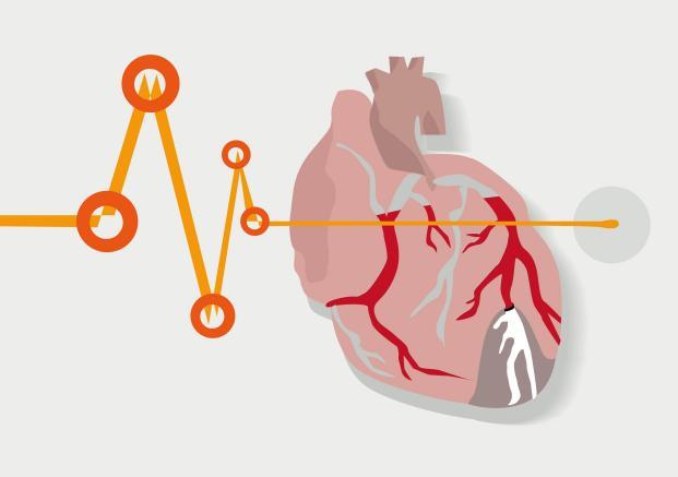 What symptoms precede a heart attack?