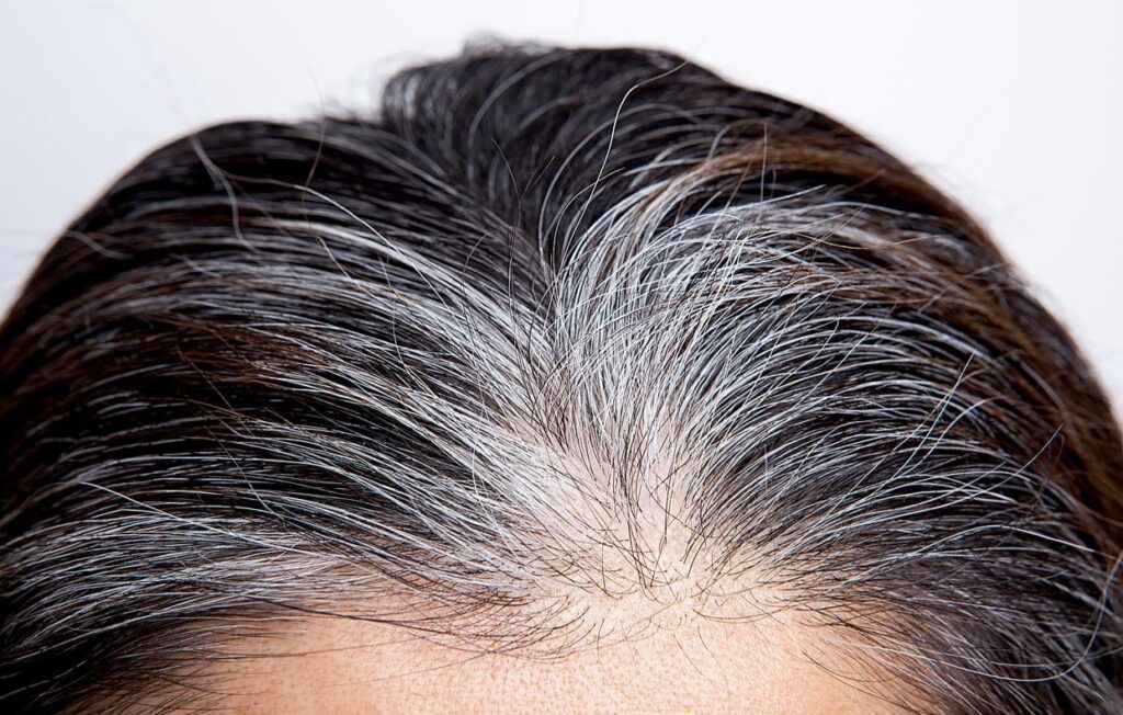 What is the Reason for Growing White Hair Fast