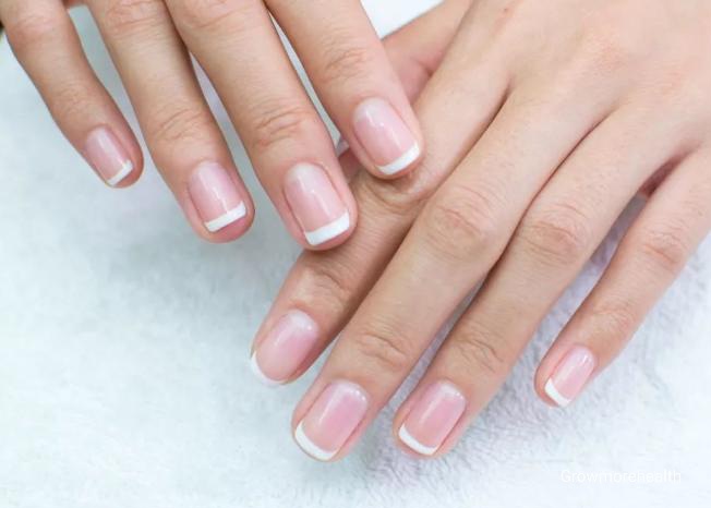 3. Take care of your nails, don't cut them randomly