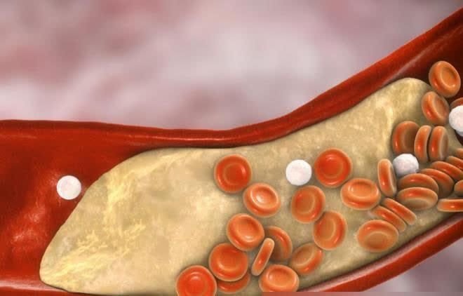 How do you get rid of cholesterol after eating?